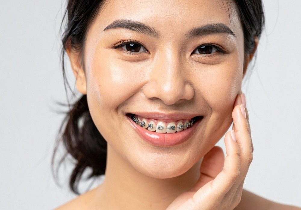 Teenager smiling with braces