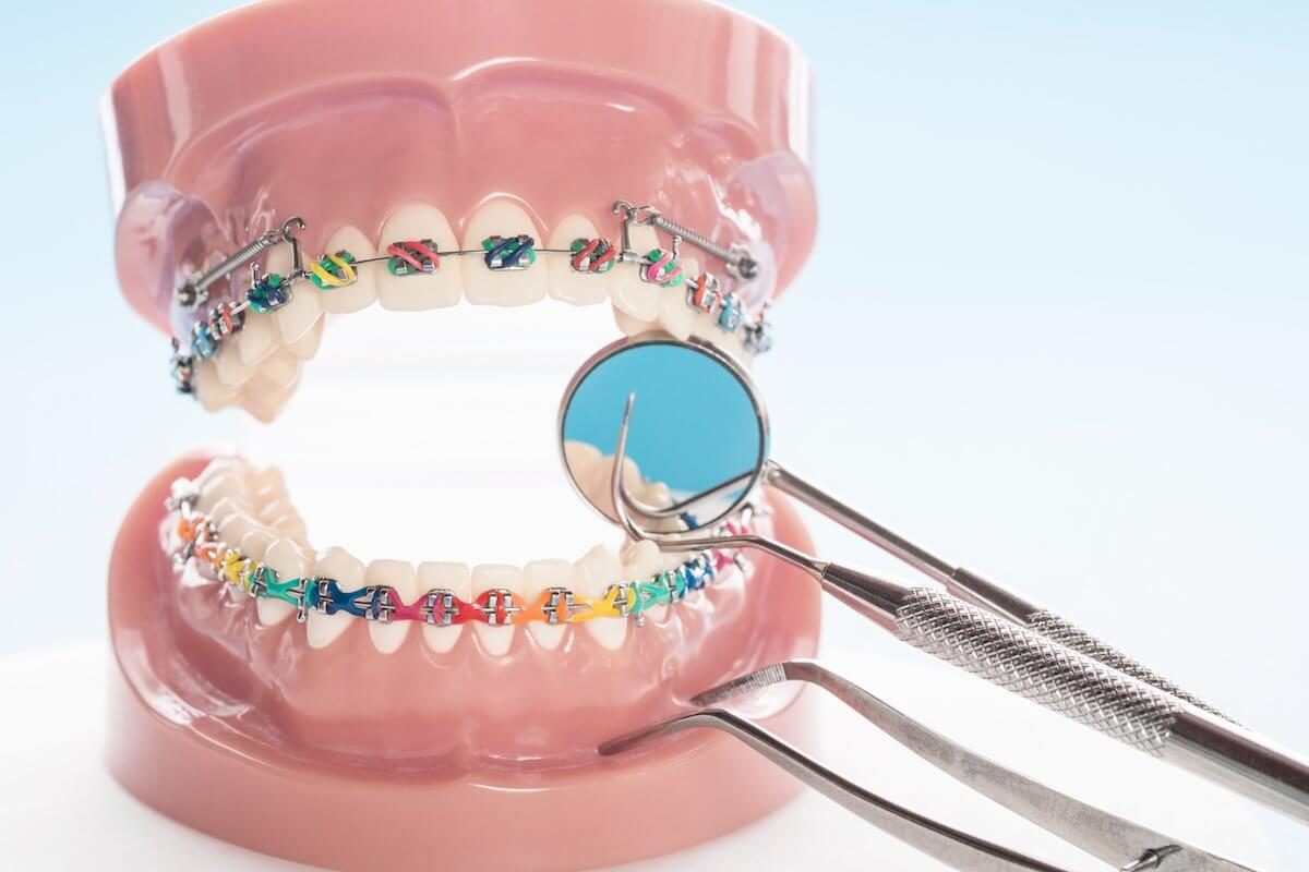 Orthodontic treatment