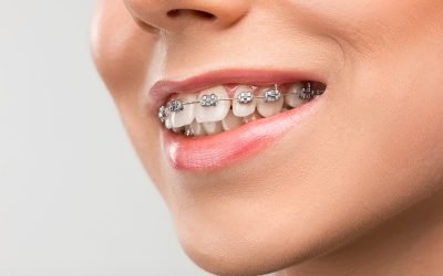 The Importance of Correcting your Overbite from Sayers Dental Aesthetics & Implants