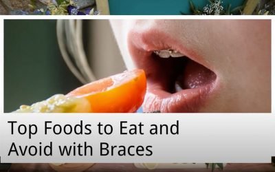 Top Foods to Eat and Avoid with Braces from Sayers Dental Aesthetics & Implants
