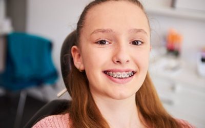 6 Actions to Take Before Getting Braces