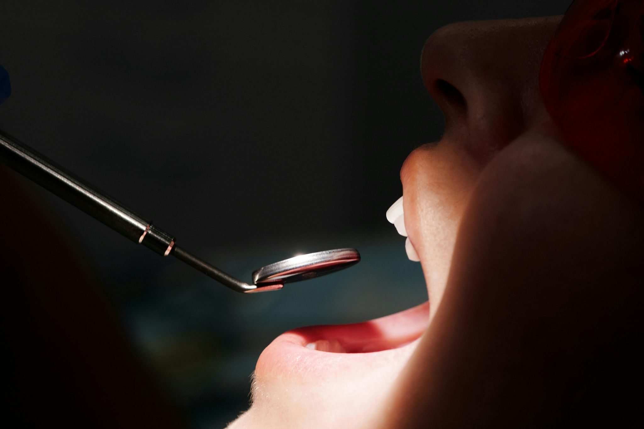 Emergency Dentistry – What to Do When Every Second Counts Dental Examinations