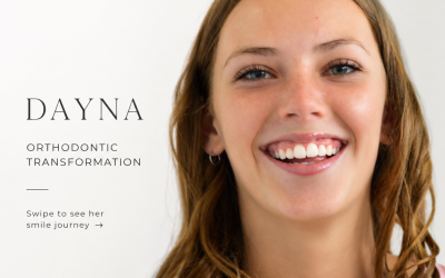 Orthodontic Treatment for Crowded Teeth | Dayna’s Smile Journey